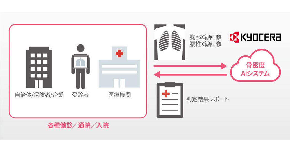 京セラと東京大学、AI骨粗しょう症診断補助システム実用化に向け「運動